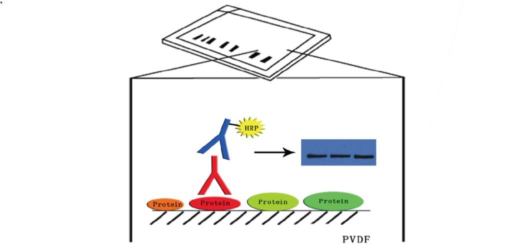 免疫蛋白印记（Western Blot）